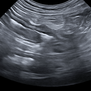 DIAGNÓSTICO ECOGRÁFICO DE PATOLOGÍAS INTESTINALES EN PEQUEÑOS ANIMALES