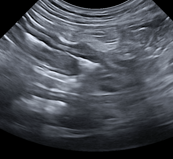 DIAGNÓSTICO ECOGRÁFICO DE PATOLOGÍAS INTESTINALES EN PEQUEÑOS ANIMALES